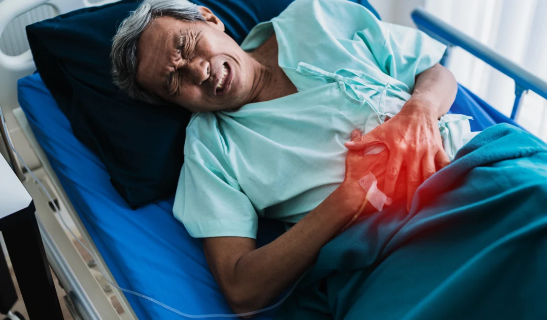 Colorectal(Colon) Cancer